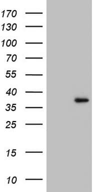 GATAD1 Antibody (aa68-269, clone OTI3B12, Carrier-free)