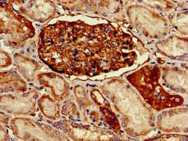 PODXL / Podocalyxin Antibody