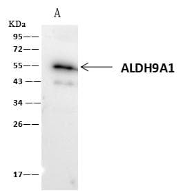 ALDH9A1 Antibody (Preservative Free)