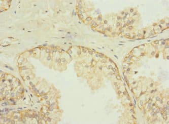 Polyclonal Rabbit anti-Human SQRDL Antibody (IHC, WB)