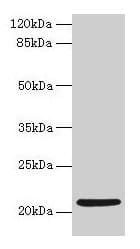 Polyclonal Rabbit anti-Human COPZ1 Antibody (IHC, WB)