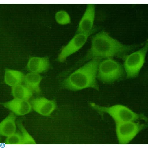 PKM / Pyruvate Kinase, Muscle Antibody
