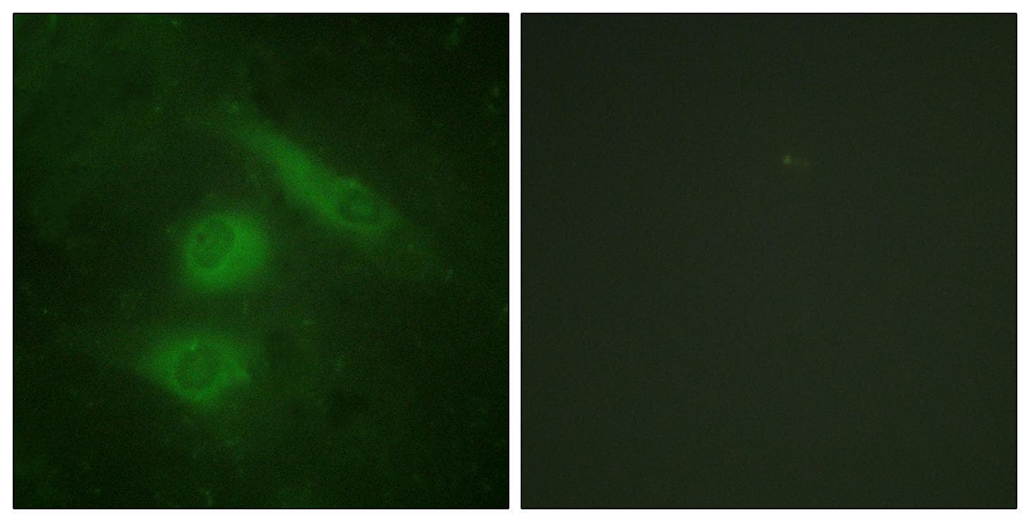 Polyclonal Rabbit anti-Human IRF3 Antibody (p385, IHC, IF, WB)