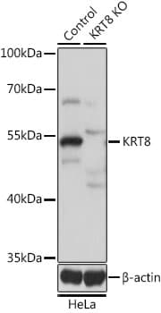 KRT8 / CK8 / Cytokeratin 8 Antibody