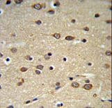 DLK2 Antibody (aa353-380)