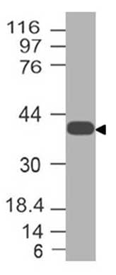 Polyclonal Rabbit anti-Human KLF8 Antibody (WB)