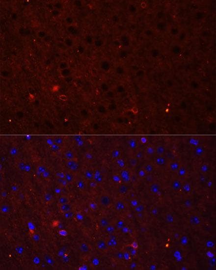 GRIA2 / GLUR2 Antibody