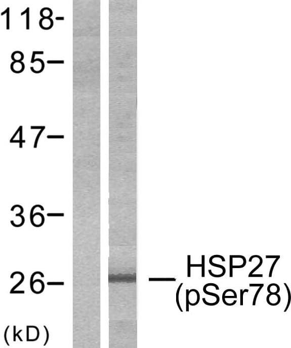HSPB1 / HSP27 Antibody (phospho-Ser78)