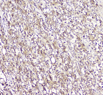 LCP1 / L-Plastin Antibody