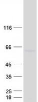 Human CEP55 Protein (Recombinant Myc-DDK (Flag))