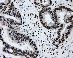 RPA2 / RFA2 / RPA34 Antibody (clone OTI9A1)