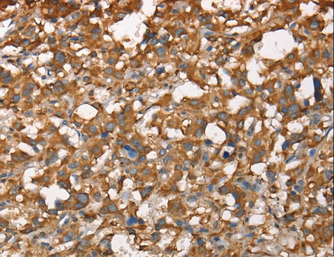CDC25A Antibody