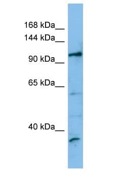Polyclonal Rabbit anti-Human FRBZ1 / ZBTB41 Antibody (aa824-873, WB)