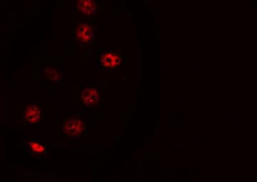 ZNF785 Antibody