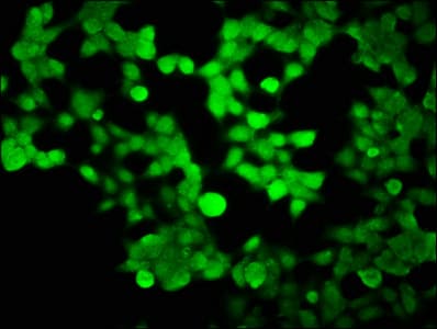Polyclonal Rabbit anti-Human HIST1H2BK Antibody