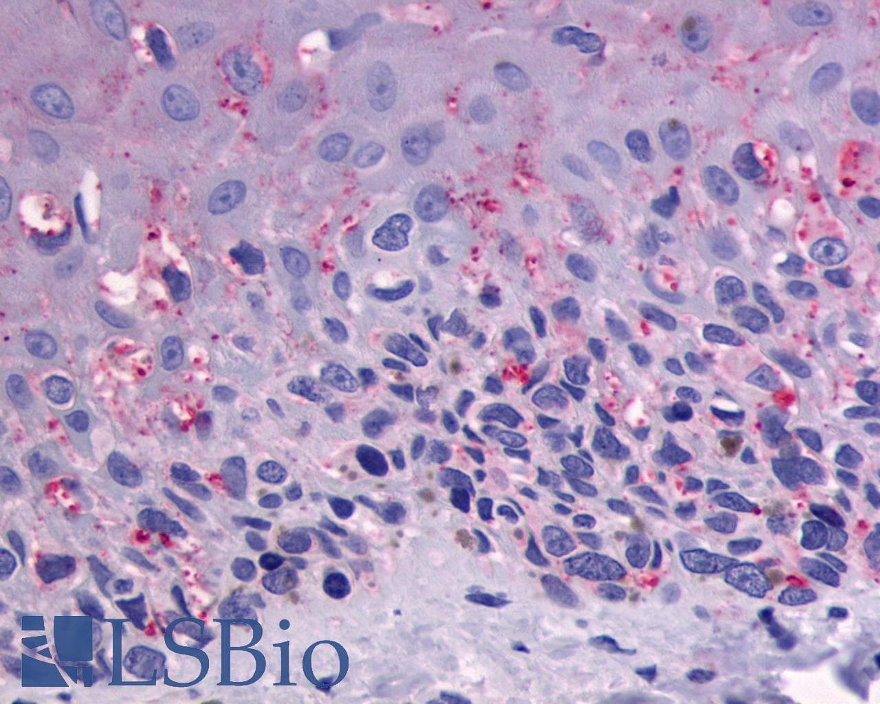 IHC-plus™ Polyclonal Rabbit anti-Human ADGRG1 / GPR56 Antibody (Cytoplasmic Domain, IHC)