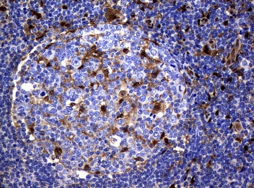 TP / Thymidine Phosphorylase Antibody (aa311-482, clone UMAB98)
