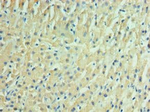Polyclonal Rabbit anti-Human IDH2 Antibody (aa193-452, IHC, WB)