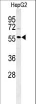 Polyclonal Rabbit anti-Human POLL / DNA Polymerase Lambda Antibody (aa549-575, WB)
