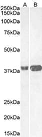 MC4R / Melanocortin 4 Receptor Antibody