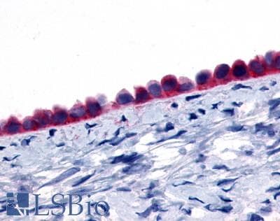 PathPlus™ ADGRD1 / GPR133 Antibody (N-Terminus)