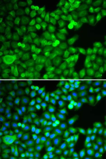 IHC-plus™ PSMB5 Antibody