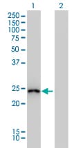 IHC-plus™ Monoclonal Mouse anti-Human GSTA1 Antibody (clone 2F7, IHC, WB)