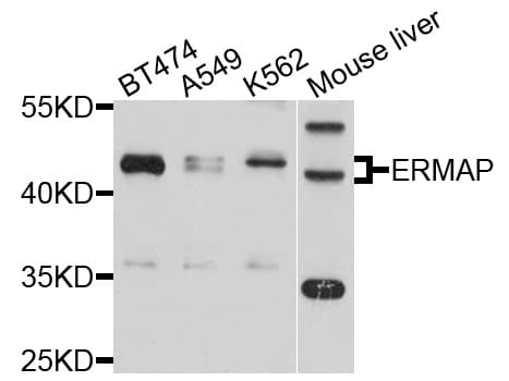 Polyclonal Rabbit anti-Human ERMAP / SC Antibody (WB)