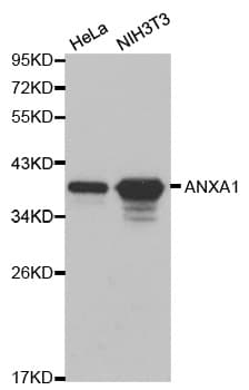 Polyclonal Rabbit anti-Human ANXA1 / Annexin A1 Antibody (IHC, IF, WB)