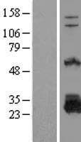 DTD1 Protein (Over-Expression Lysate Myc-DDK (Flag))