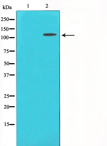 IL6ST / CD130 / gp130 Antibody