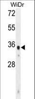 Polyclonal Rabbit anti-Human WDR5B Antibody (aa58-85, WB)