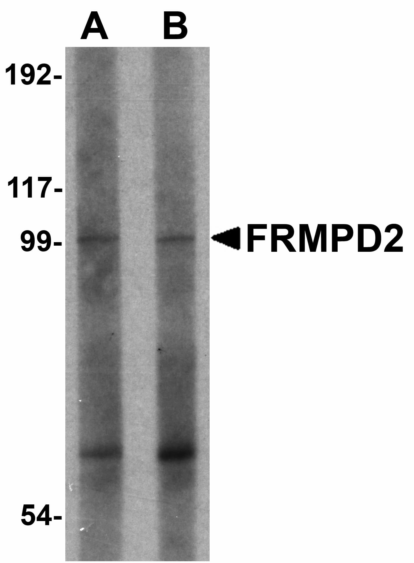 Polyclonal Rabbit anti-Human FRMPD2 Antibody (IHC, WB)