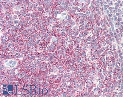 DDR2 Antibody (aa578-817)