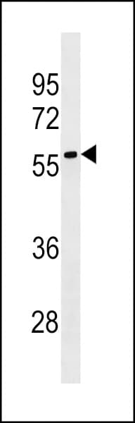 Polyclonal Rabbit anti-Human LRRC69 Antibody (aa200-227, WB)