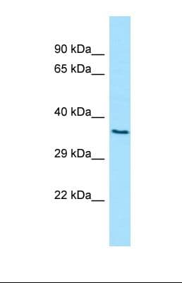 D2HGDH Antibody (aa69-118)