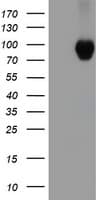 IHC-plus™ CTNNB1 / Beta Catenin Antibody (clone 1H10)