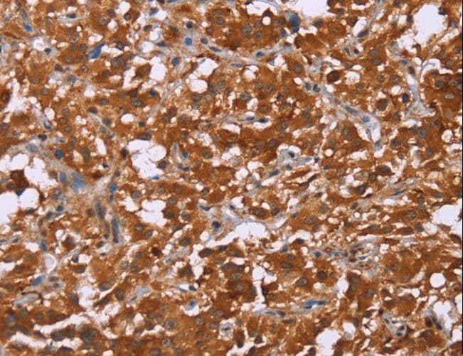 IHC-plus™ DCBLD2 Antibody