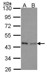 Polyclonal Rabbit anti-Human IVD Antibody (aa1-222, IHC, WB)