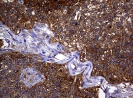 NME1 / NM23 Antibody (clone OTI22F10)
