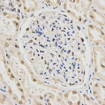 SNRPE Antibody