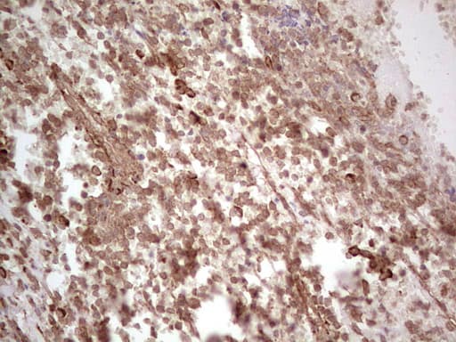 PROCR / EPCR Antibody (aa1-210, clone OTI5A8)
