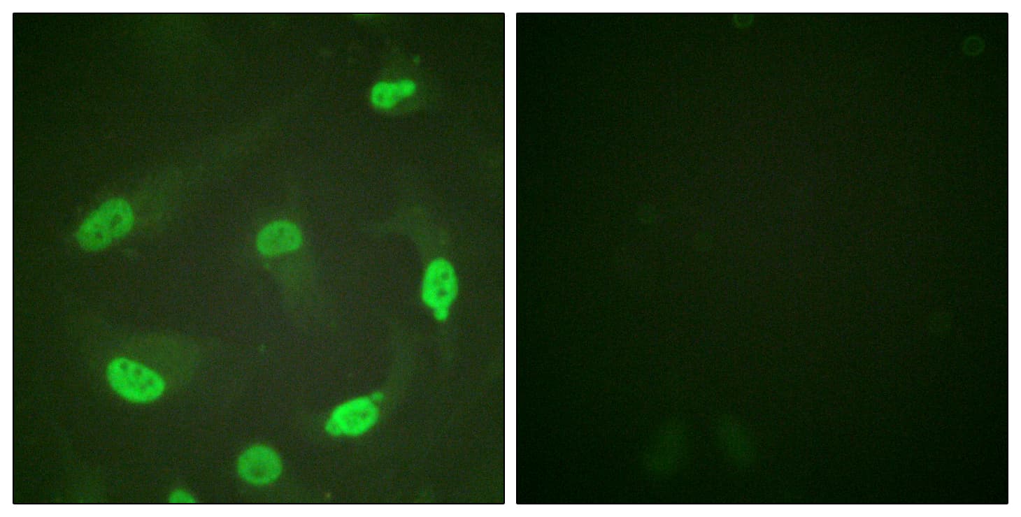 IHC-plus™ Polyclonal Rabbit anti-Human TP53 / p53 Antibody (Acetyl-Lys379, IHC, IF)
