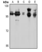 Polyclonal Rabbit anti-Human GRM7 / MGLUR7 Antibody (IF, WB)