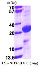 Human DENR / Density Regulated Protein (Recombinant His)