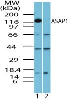 ASAP1 Antibody (aa962-978)