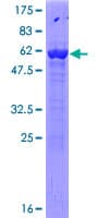 Human ACY3 Protein (Recombinant GST)