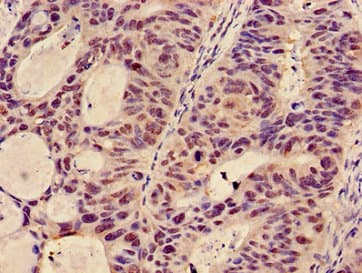 Polyclonal Rabbit anti-Human GCNT3 Antibody (IHC, WB)