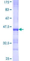 Human ACAN / Aggrecan Protein (Recombinant GST, N-terminus)
