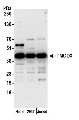 TMOD3 / Tropomodulin 3 Antibody (aa302-352)